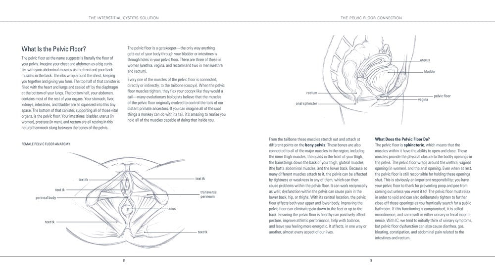 The Interstitial Cystitis Solution
