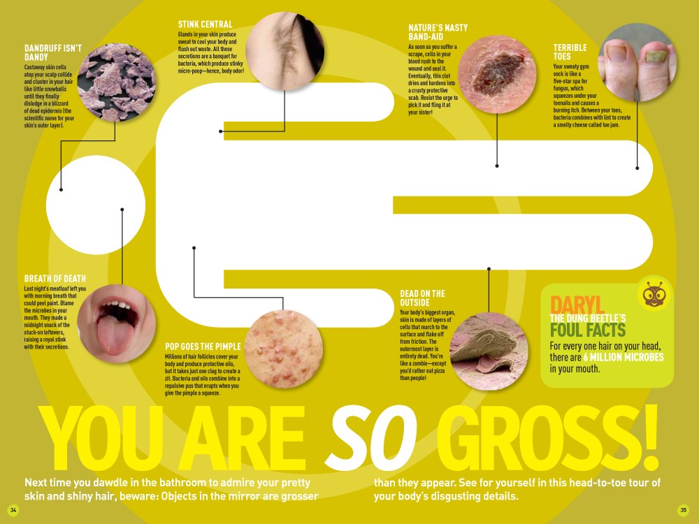 That's Gross!