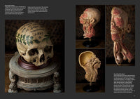 Skulls